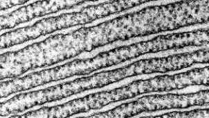 Black and white image showing a detailed texture of wavy, parallel lines resembling the pattern seen in a cross-section of muscle fibers.