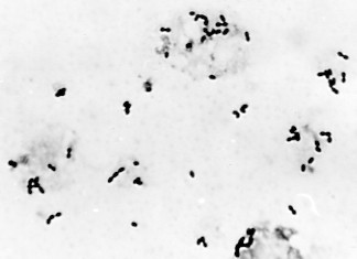 Black and white image showing scattered bacterial rods and cocci under a microscope, on a light background.