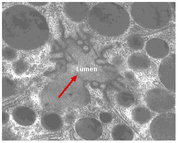 Microscopic image showing multiple circular structures with varying sizes. A central region labeled Lumen is indicated by a red arrow. The background is textured and gray.