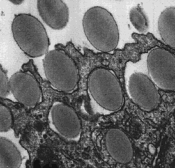 Microscopic view of oval-shaped bacterial cells with textured surfaces, clustered together. The cells are dark against a lighter background.