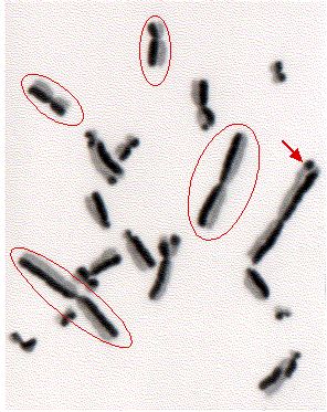 Black and white image showing multiple chromosomes isolated on a light background. Some chromosomes are circled in red, and one is indicated with a red arrow.