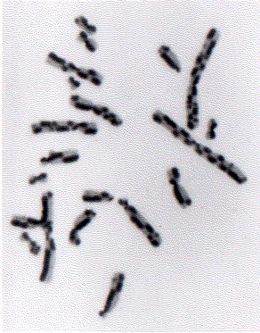 Black and white image showing human chromosomes scattered on a light background. Various sizes and shapes of paired chromosomes are visible.